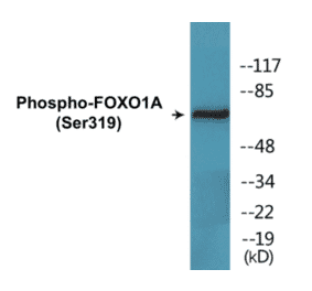 Western Blot - FOXO1A (phospho Ser319) Cell Based ELISA Kit (CBP1557) - Antibodies.com