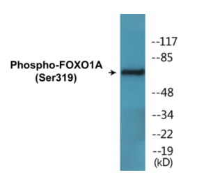 Western Blot - FOXO1A (phospho Ser319) Cell Based ELISA Kit (CBP1557) - Antibodies.com