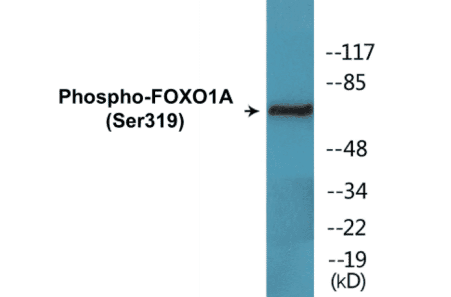 Western Blot - FOXO1A (phospho Ser319) Cell Based ELISA Kit (CBP1557) - Antibodies.com