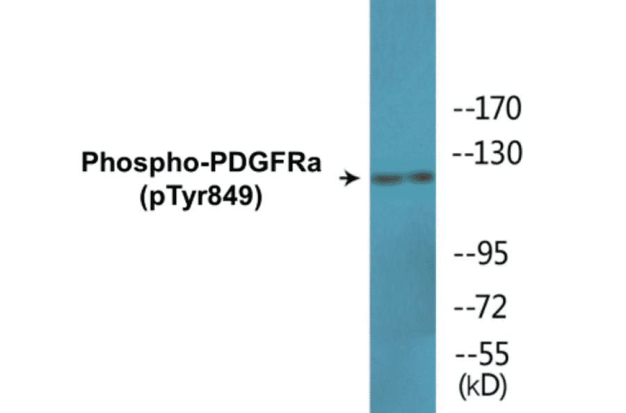 Western Blot - PDGFRa (phospho Tyr849) Cell Based ELISA Kit (CBP1780) - Antibodies.com