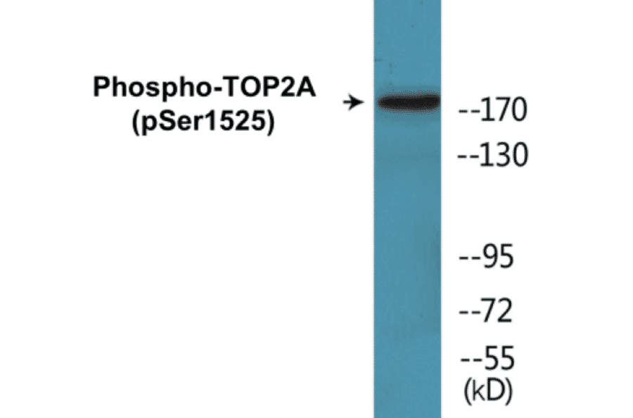 Western Blot - TOP2A (phospho Ser1525) Cell Based ELISA Kit (CBP1843) - Antibodies.com