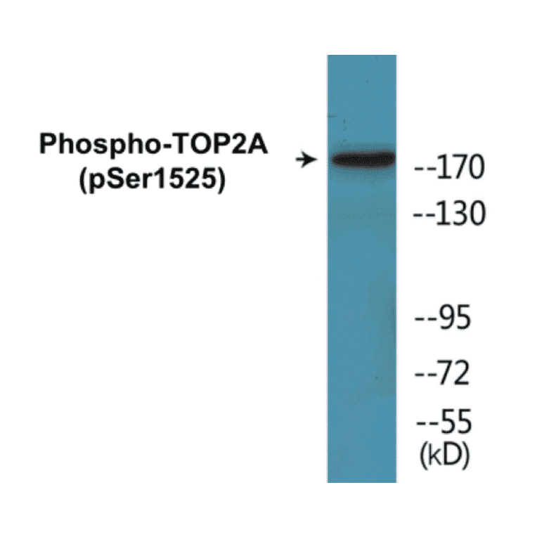 Western Blot - TOP2A (phospho Ser1525) Cell Based ELISA Kit (CBP1843) - Antibodies.com