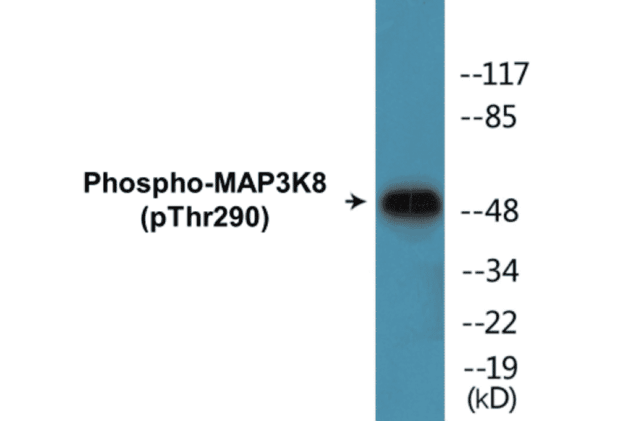 Western Blot - MAP3K8 (phospho Thr290) Cell Based ELISA Kit (CBP1057) - Antibodies.com