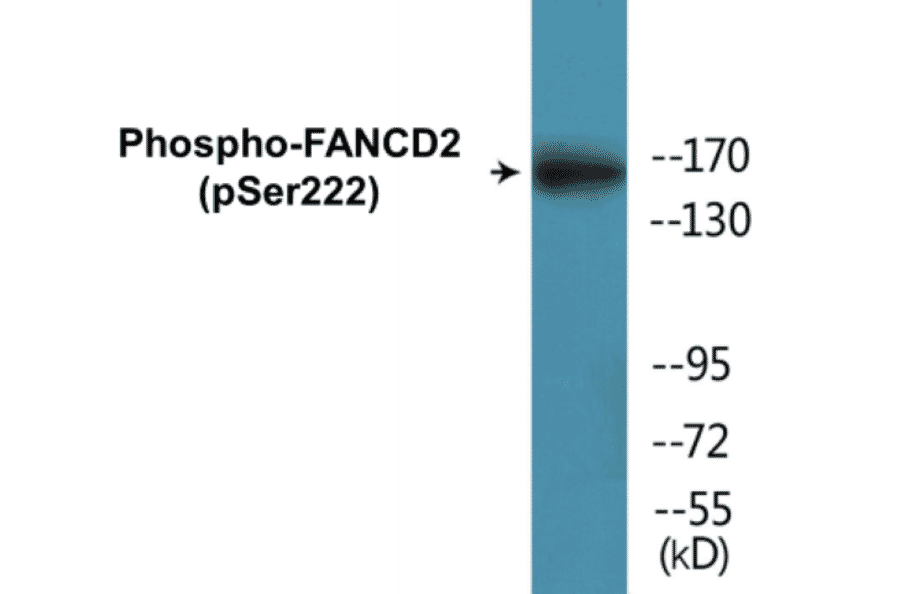 Western Blot - FANCD2 (phospho Ser222) Cell Based ELISA Kit (CBP1116) - Antibodies.com