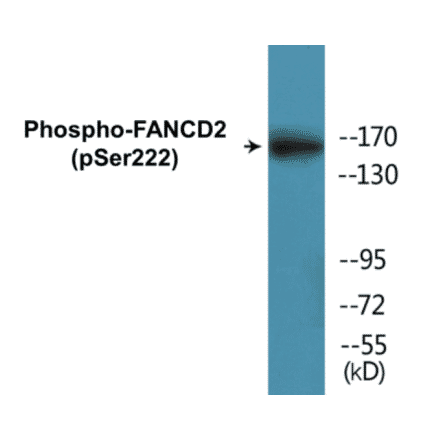 Western Blot - FANCD2 (phospho Ser222) Cell Based ELISA Kit (CBP1116) - Antibodies.com