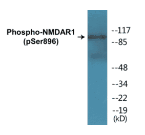 Western Blot - NMDAR1 (phospho Ser896) Cell Based ELISA Kit (CBP1264) - Antibodies.com