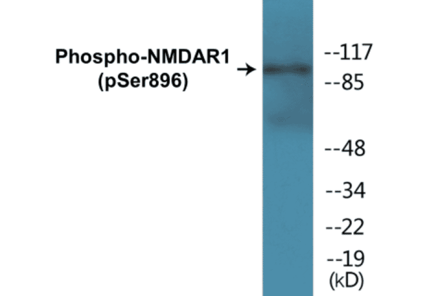 Western Blot - NMDAR1 (phospho Ser896) Cell Based ELISA Kit (CBP1264) - Antibodies.com