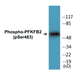 Western Blot - PFKFB2 (phospho Ser483) Cell Based ELISA Kit (CBP1287) - Antibodies.com