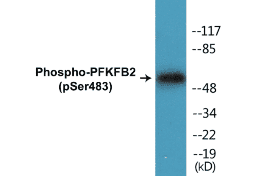 Western Blot - PFKFB2 (phospho Ser483) Cell Based ELISA Kit (CBP1287) - Antibodies.com