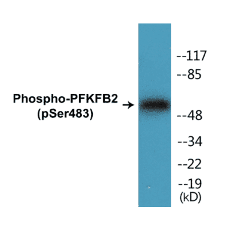 Western Blot - PFKFB2 (phospho Ser483) Cell Based ELISA Kit (CBP1287) - Antibodies.com