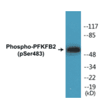 Western Blot - PFKFB2 (phospho Ser483) Cell Based ELISA Kit (CBP1287) - Antibodies.com