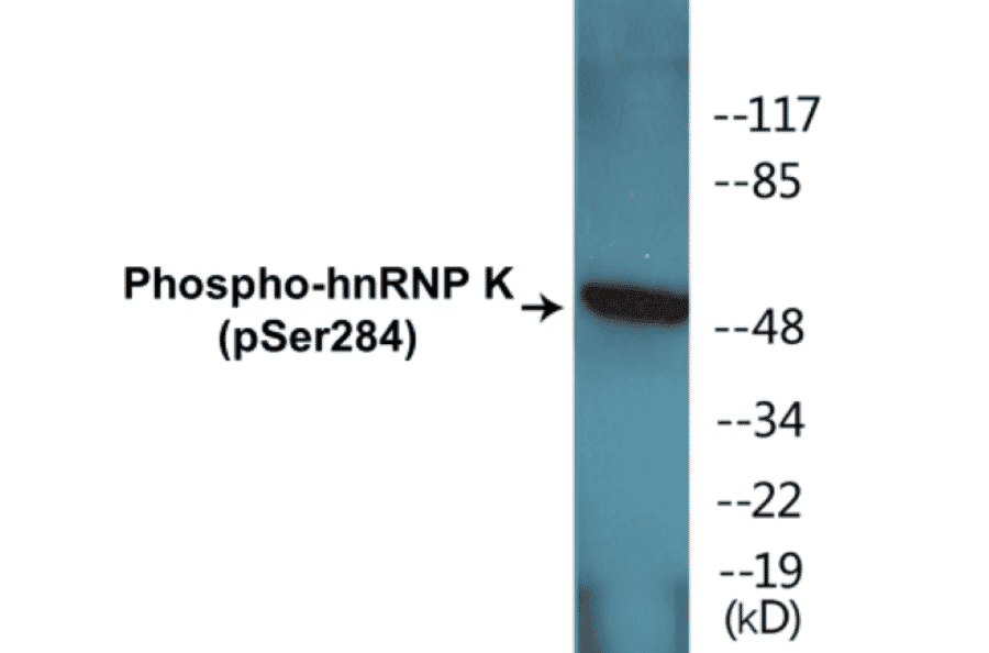 Western Blot - hnRNPK (phospho Ser284) Cell Based ELISA Kit (CBP1410) - Antibodies.com