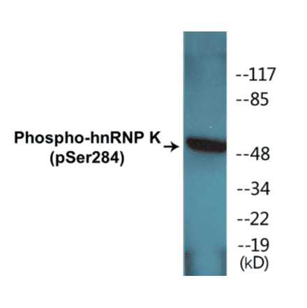 Western Blot - hnRNPK (phospho Ser284) Cell Based ELISA Kit (CBP1410) - Antibodies.com