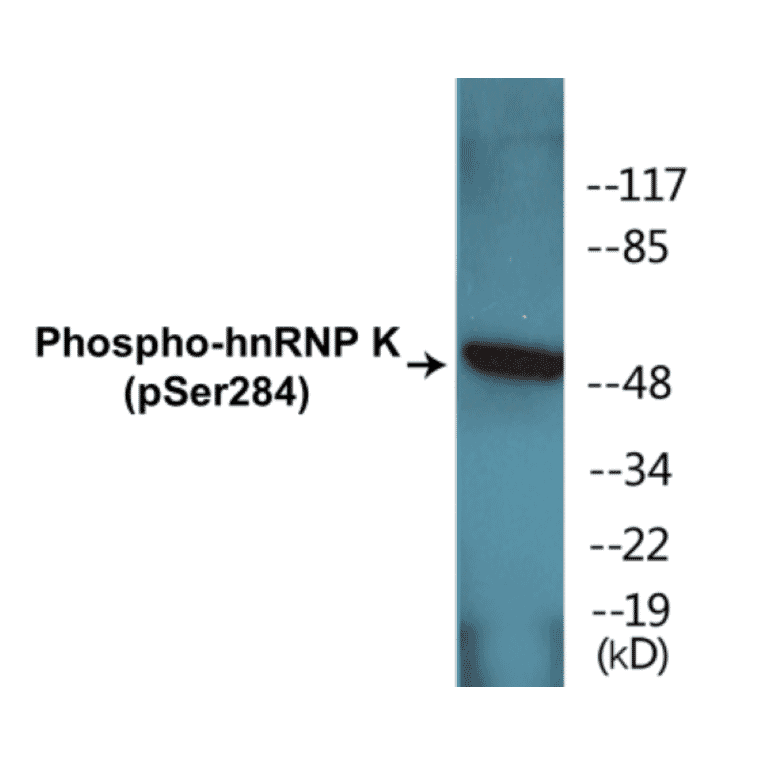 Western Blot - hnRNPK (phospho Ser284) Cell Based ELISA Kit (CBP1410) - Antibodies.com