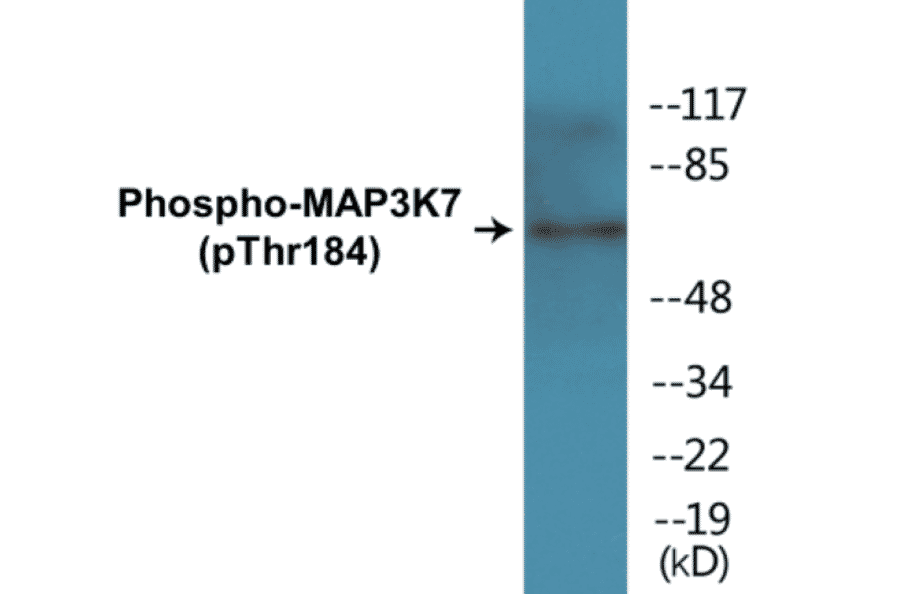 Western Blot - MAP3K7 (phospho Thr184) Cell Based ELISA Kit (CBP1440) - Antibodies.com