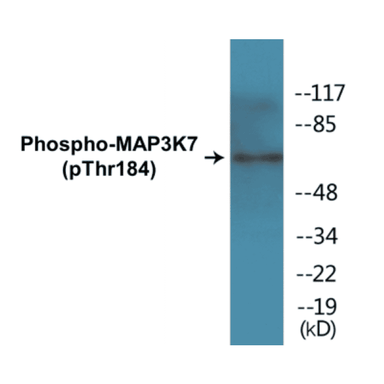 Western Blot - MAP3K7 (phospho Thr184) Cell Based ELISA Kit (CBP1440) - Antibodies.com