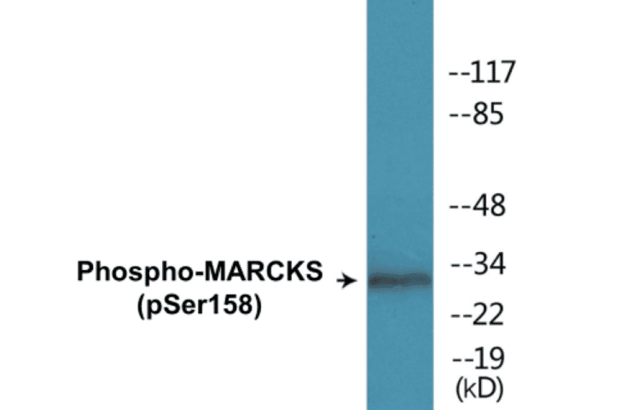 Western Blot - MARCKS (phospho Ser158) Cell Based ELISA Kit (CBP1607) - Antibodies.com