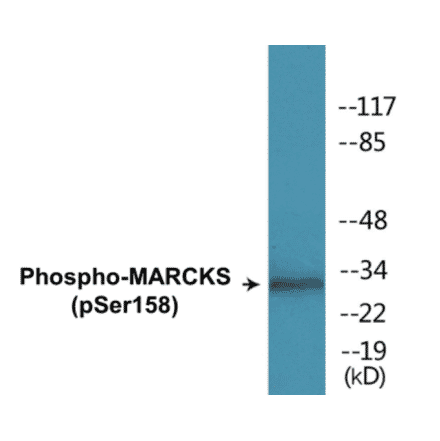 Western Blot - MARCKS (phospho Ser158) Cell Based ELISA Kit (CBP1607) - Antibodies.com