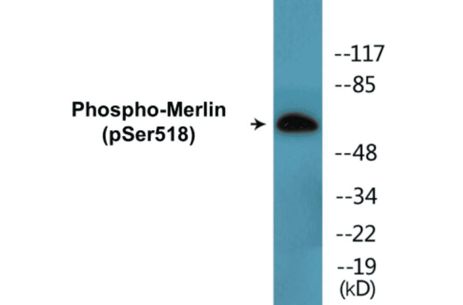 Western Blot - Merlin (phospho Ser518) Cell Based ELISA Kit (CBP1614) - Antibodies.com