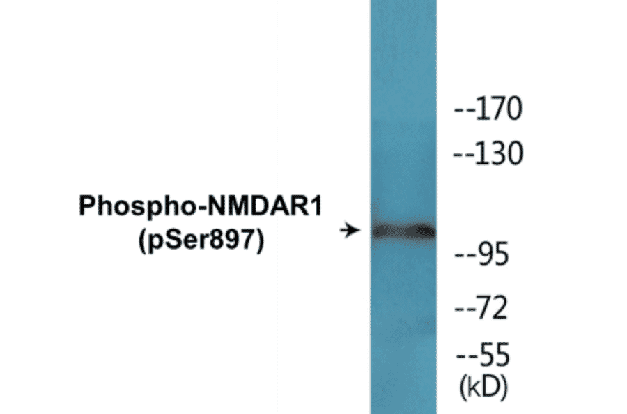 Western Blot - NMDAR1 (phospho Ser897) Cell Based ELISA Kit (CBP1636) - Antibodies.com