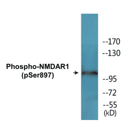 Western Blot - NMDAR1 (phospho Ser897) Cell Based ELISA Kit (CBP1636) - Antibodies.com