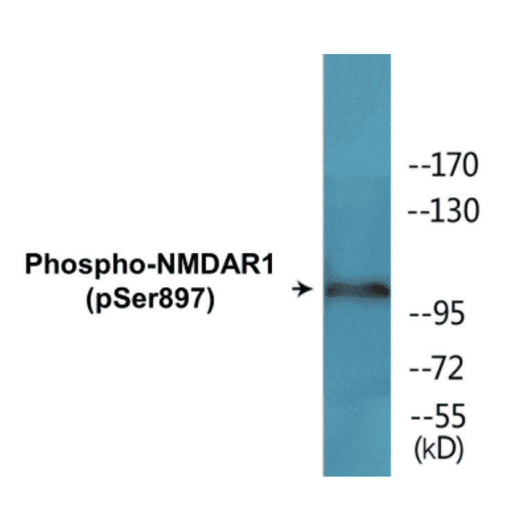 Western Blot - NMDAR1 (phospho Ser897) Cell Based ELISA Kit (CBP1636) - Antibodies.com