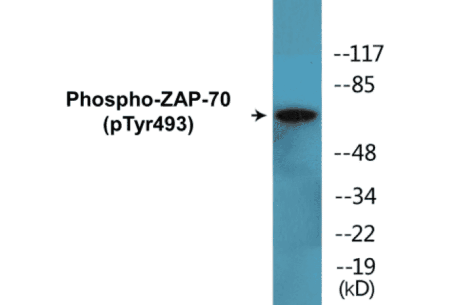 Western Blot - ZAP-70 (phospho Tyr493) Cell Based ELISA Kit (CBP1709) - Antibodies.com