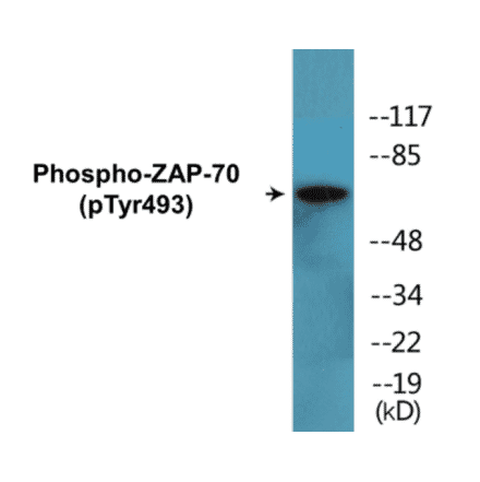 Western Blot - ZAP-70 (phospho Tyr493) Cell Based ELISA Kit (CBP1709) - Antibodies.com