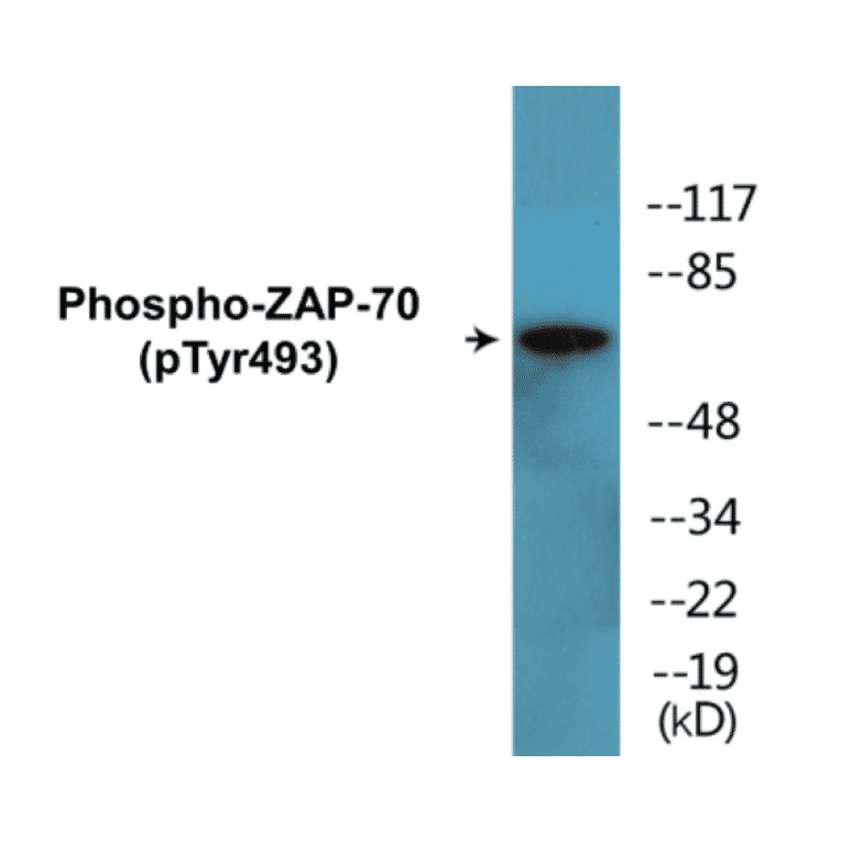 Western Blot - ZAP-70 (phospho Tyr493) Cell Based ELISA Kit (CBP1709) - Antibodies.com