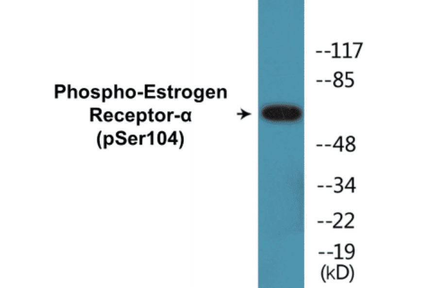 Western Blot - Estrogen Receptor alpha (phospho Ser104) Cell Based ELISA Kit (CBP1546) - Antibodies.com