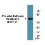 Western Blot - Estrogen Receptor alpha (phospho Ser104) Cell Based ELISA Kit (CBP1546) - Antibodies.com