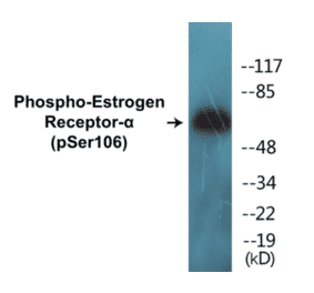 Western Blot - Estrogen Receptor alpha (phospho Ser106) Cell Based ELISA Kit (CBP1547) - Antibodies.com