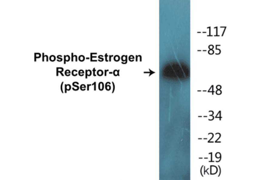 Western Blot - Estrogen Receptor alpha (phospho Ser106) Cell Based ELISA Kit (CBP1547) - Antibodies.com