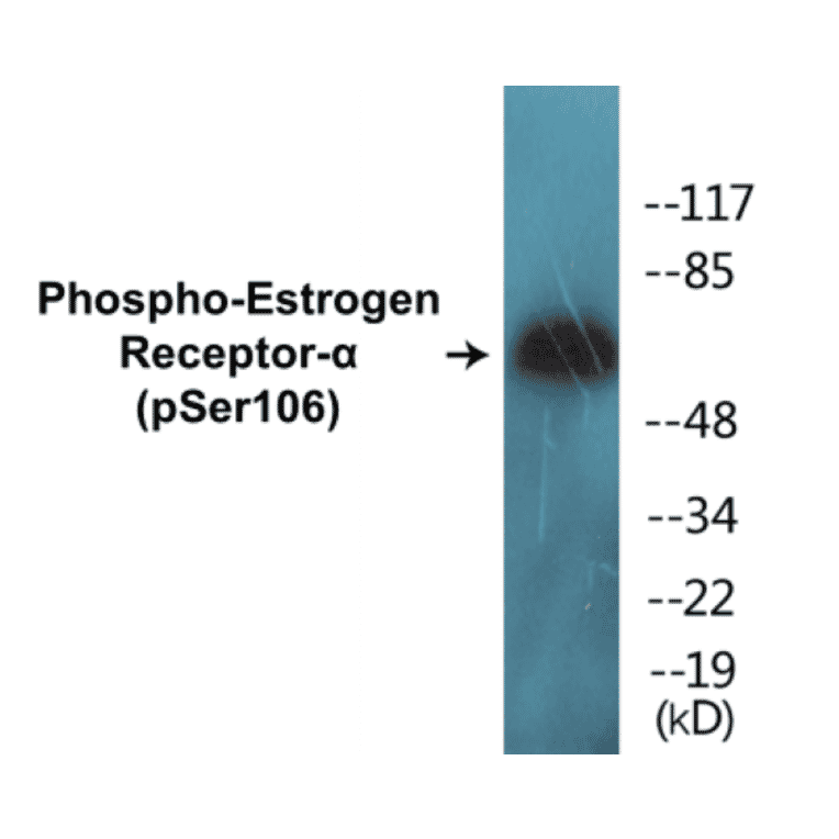 Western Blot - Estrogen Receptor alpha (phospho Ser106) Cell Based ELISA Kit (CBP1547) - Antibodies.com