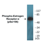 Western Blot - Estrogen Receptor alpha (phospho Ser106) Cell Based ELISA Kit (CBP1547) - Antibodies.com