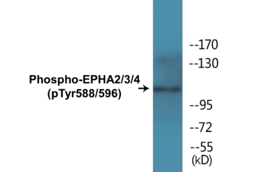 Western Blot - EPHA2 + 3 + 4 (phospho Tyr588 + Tyr596) Cell Based ELISA Kit (CBP1365) - Antibodies.com