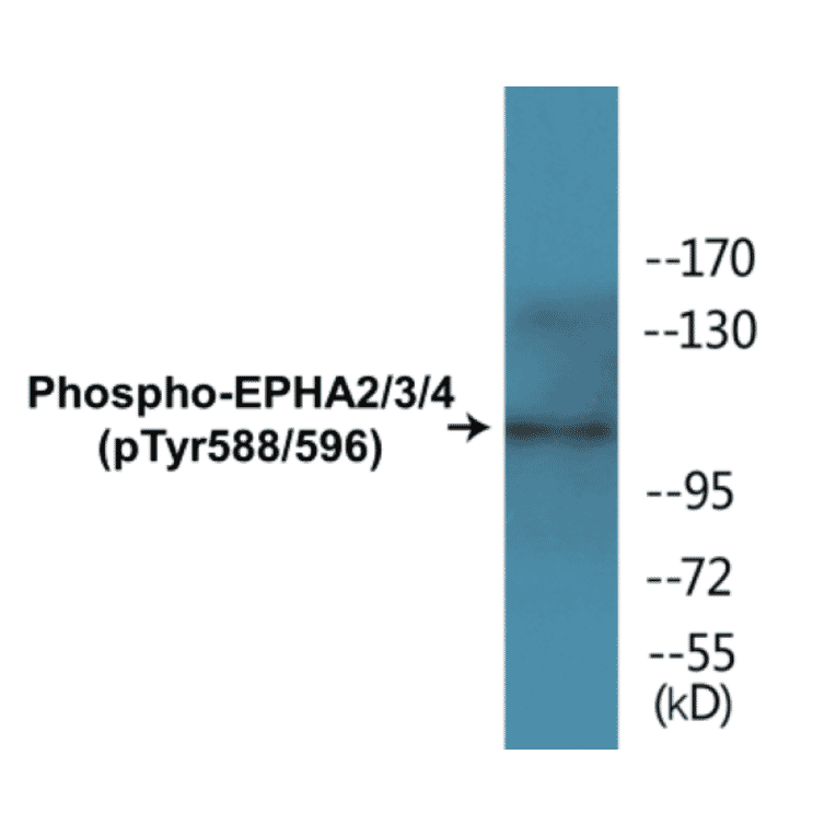 Western Blot - EPHA2 + 3 + 4 (phospho Tyr588 + Tyr596) Cell Based ELISA Kit (CBP1365) - Antibodies.com