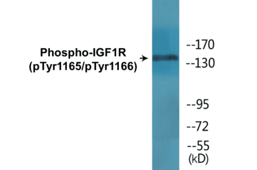 Western Blot - IGF1R (phospho Tyr1165 + Tyr1166) Cell Based ELISA Kit (CBP1584) - Antibodies.com