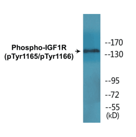 Western Blot - IGF1R (phospho Tyr1165 + Tyr1166) Cell Based ELISA Kit (CBP1584) - Antibodies.com