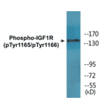 Western Blot - IGF1R (phospho Tyr1165 + Tyr1166) Cell Based ELISA Kit (CBP1584) - Antibodies.com