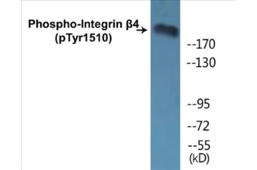 Western Blot - Integrin beta 4 (phospho Tyr1510) Cell Based ELISA Kit (CBP1427) - Antibodies.com