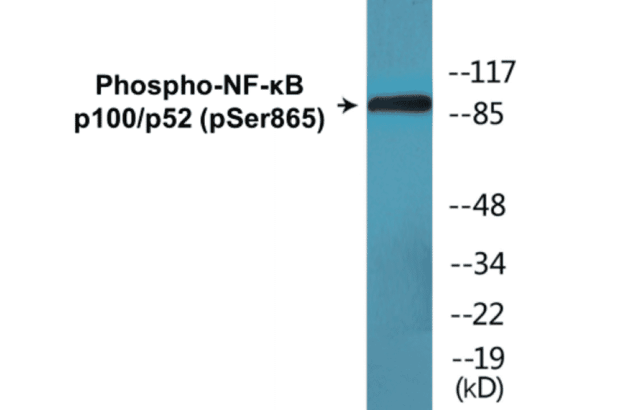 Western Blot - NF-kB p100 / p52 (phospho Ser865) Cell Based ELISA Kit (CBP1626) - Antibodies.com