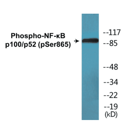 Western Blot - NF-kB p100 / p52 (phospho Ser865) Cell Based ELISA Kit (CBP1626) - Antibodies.com