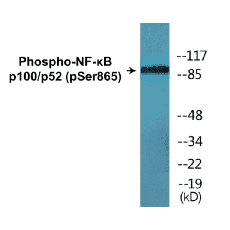 Western Blot - NF-kB p100 / p52 (phospho Ser865) Cell Based ELISA Kit (CBP1626) - Antibodies.com