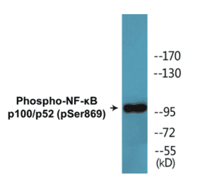 Western Blot - NF-kB p100 / p52 (phospho Ser869) Cell Based ELISA Kit (CBP1627) - Antibodies.com