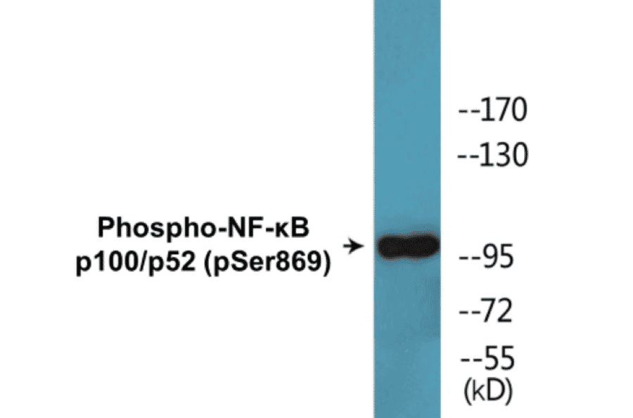 Western Blot - NF-kB p100 / p52 (phospho Ser869) Cell Based ELISA Kit (CBP1627) - Antibodies.com