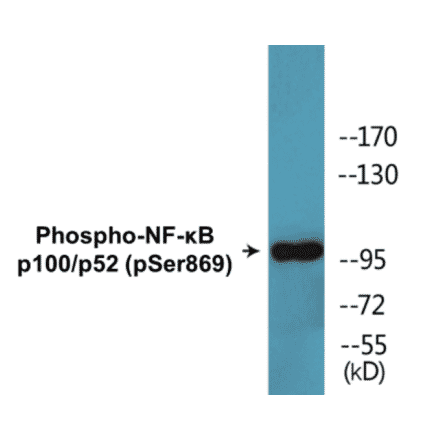 Western Blot - NF-kB p100 / p52 (phospho Ser869) Cell Based ELISA Kit (CBP1627) - Antibodies.com