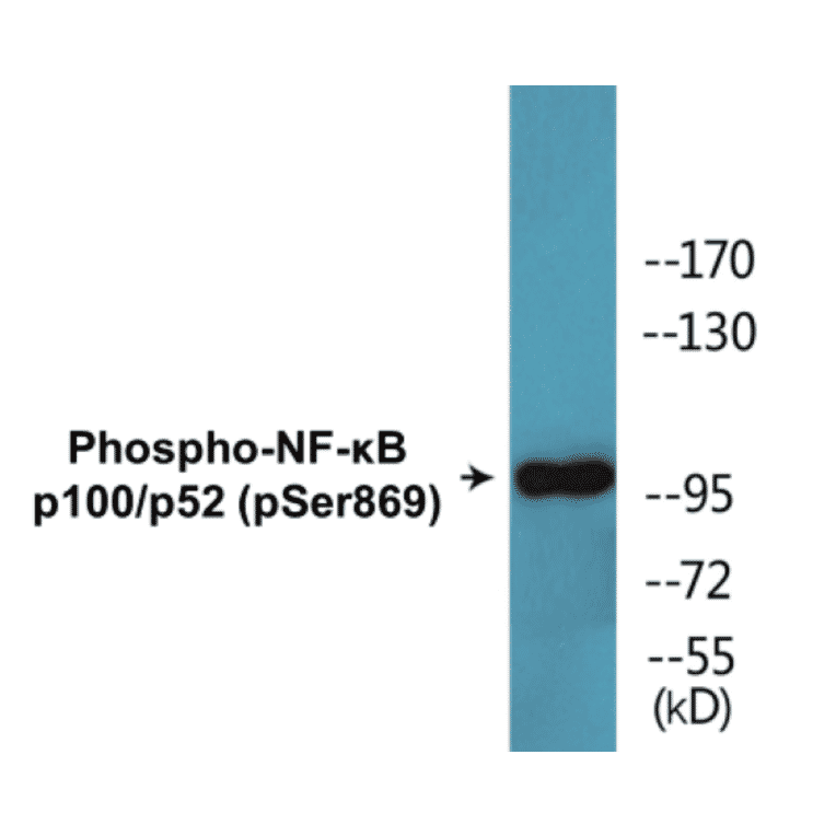 Western Blot - NF-kB p100 / p52 (phospho Ser869) Cell Based ELISA Kit (CBP1627) - Antibodies.com