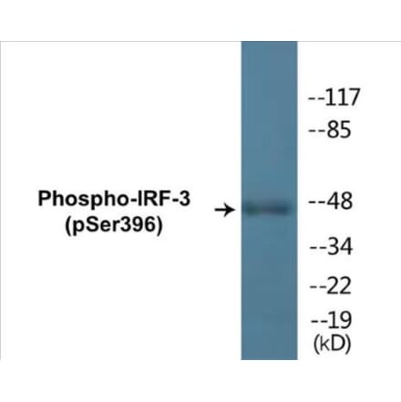 Western Blot - IRF-3 (phospho Ser396) Cell Based ELISA Kit (CBP1253) - Antibodies.com