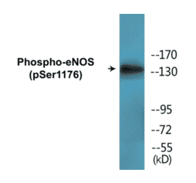Western Blot - eNOS (phospho Ser1176) Cell Based ELISA Kit (CBP1542) - Antibodies.com